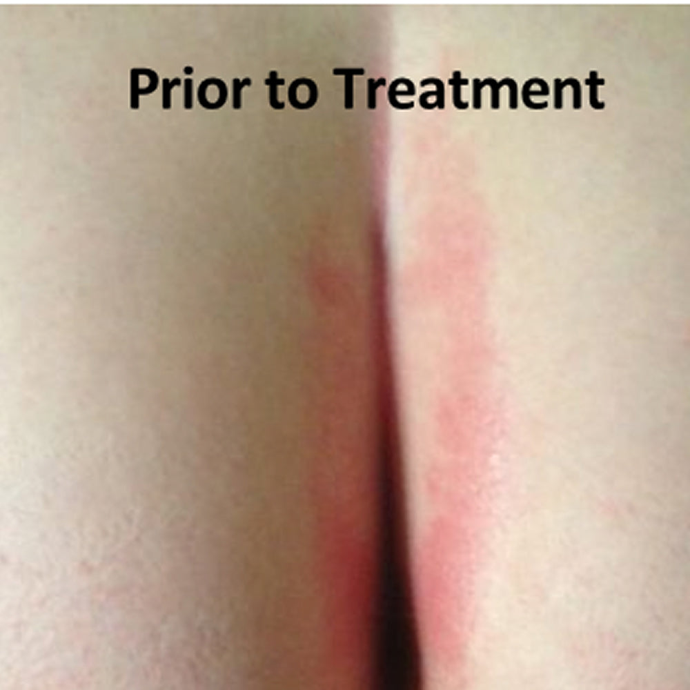 Butt Cream / Diaper Rash and Chaffing Relief Cream