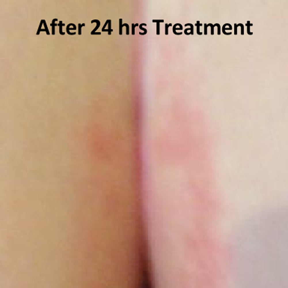 Butt Cream / Diaper Rash and Chaffing Relief Cream