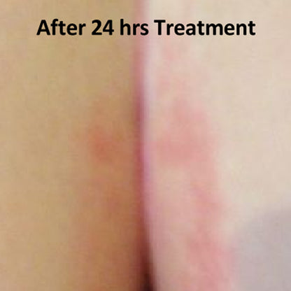 Butt Cream / Diaper Rash and Chaffing  Relief Cream