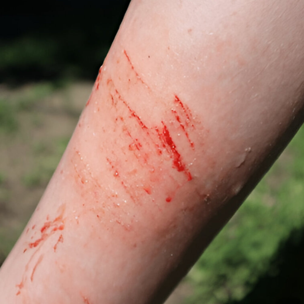 Wound Care Gel / Wound Relief Gel